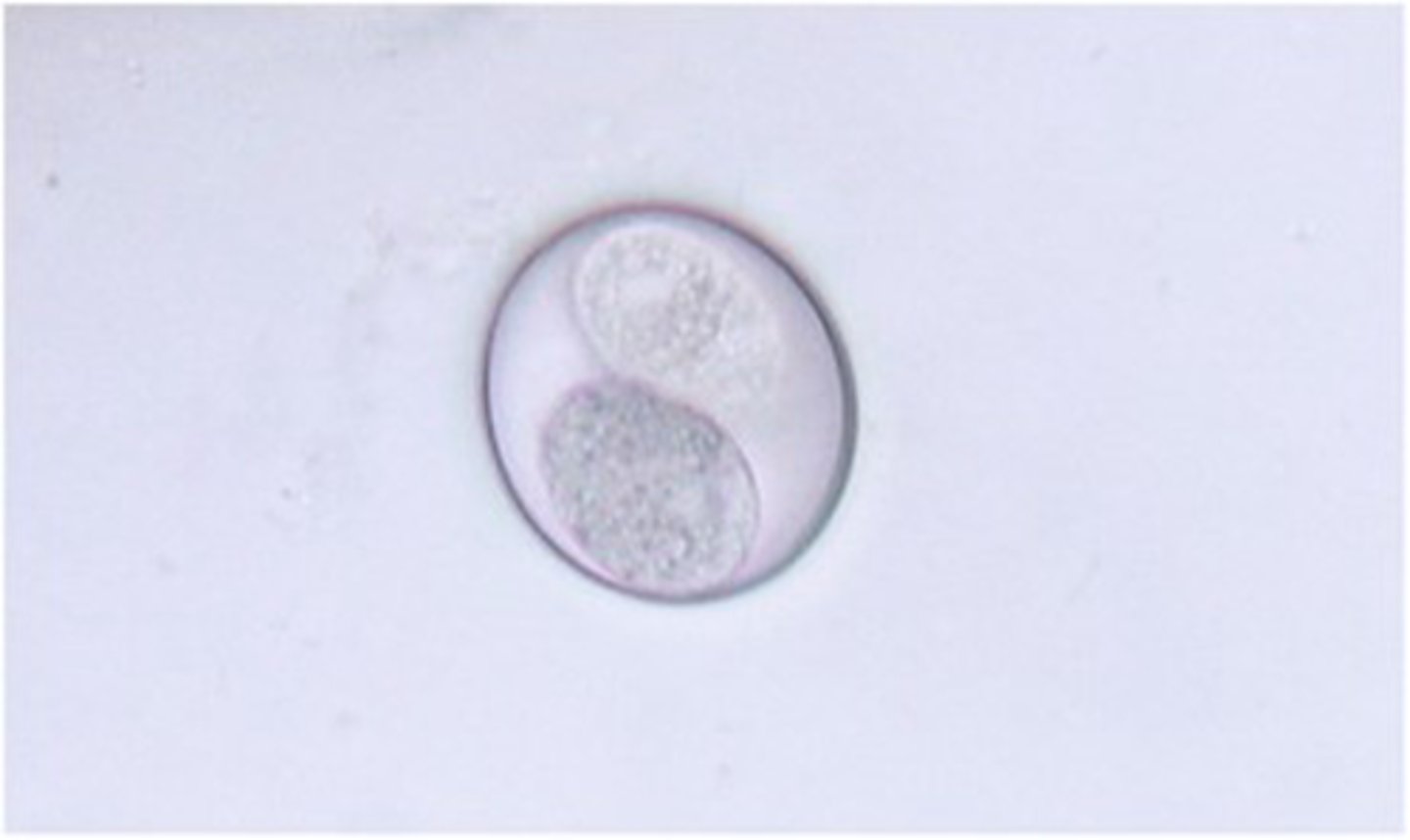 <p>This sporulated oocyst belonging to Cystoisospora rivolta is found in the feces of the:</p>