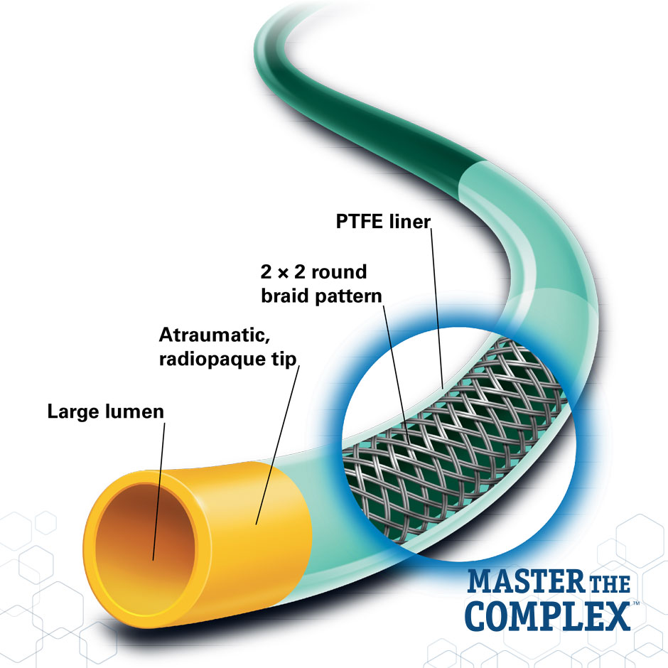 <p><strong>MACH 1<span data-name="tm" data-type="emoji">™</span> Guiding Catheter</strong></p>