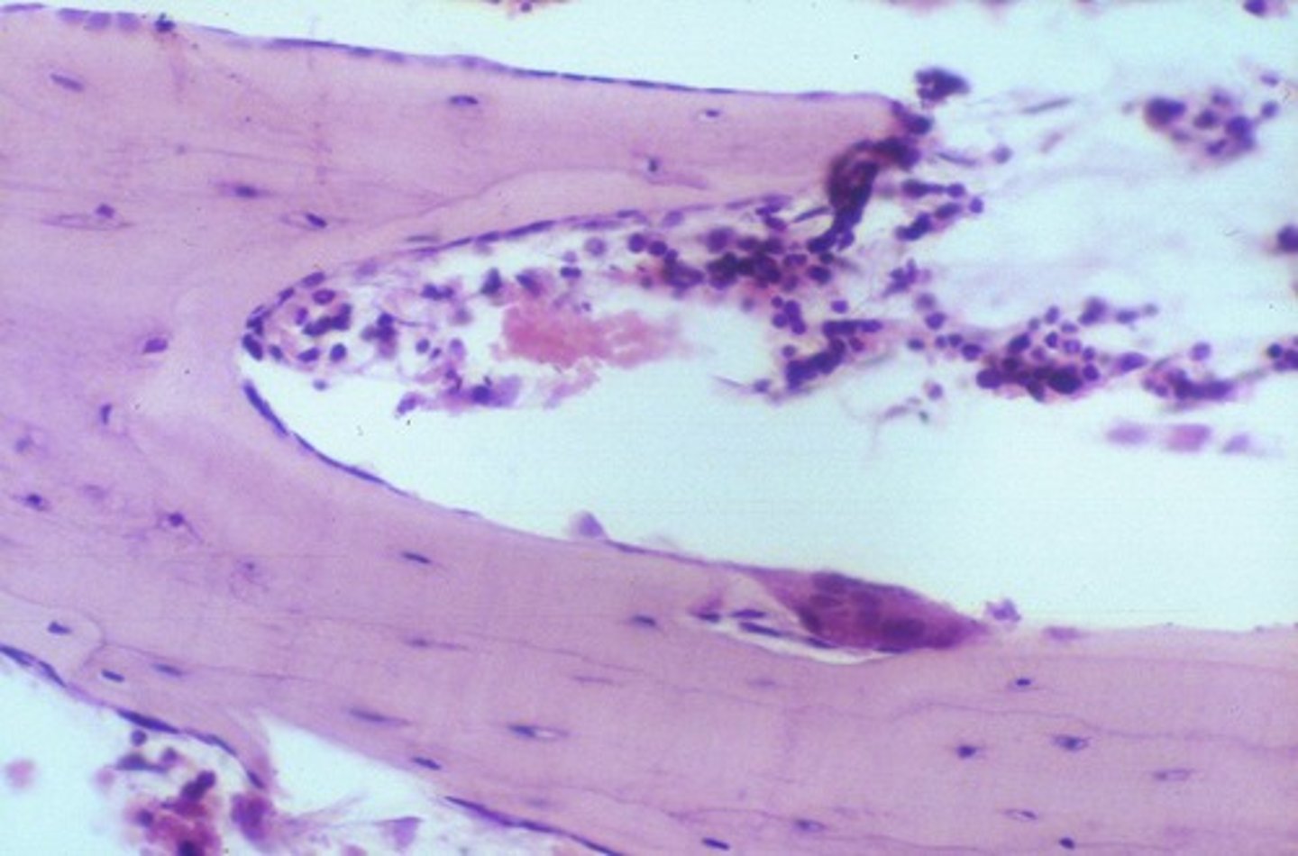 <p>Cells that resorb bone tissue.</p>