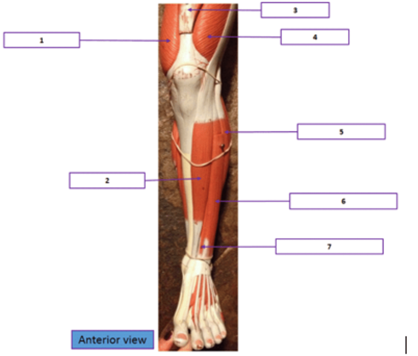 <p>Identify the muscle labeled 5.</p>