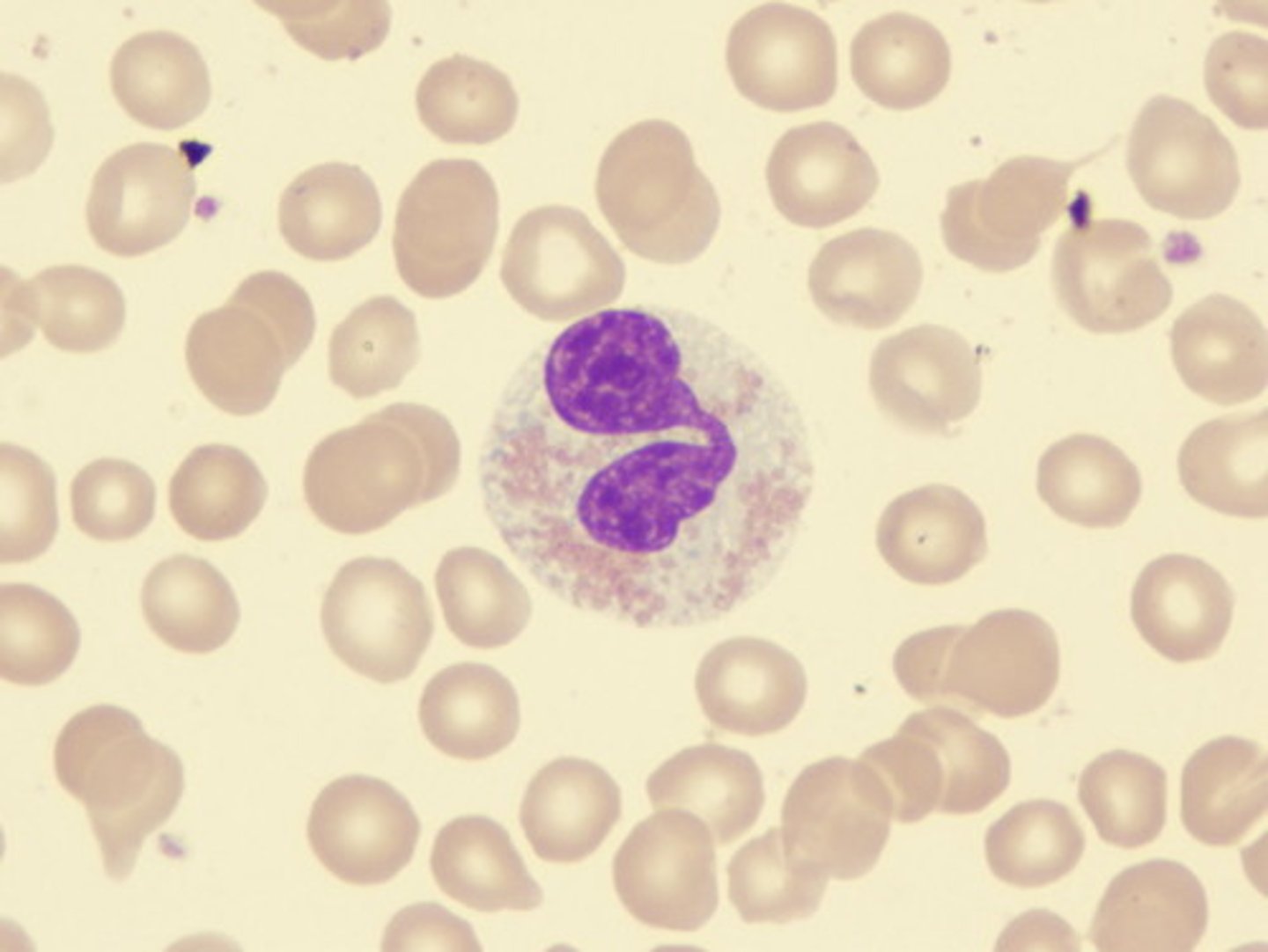 <p>Eosinophil</p>