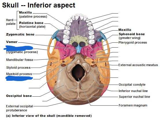 <p>temporal bone (inferior view)</p>