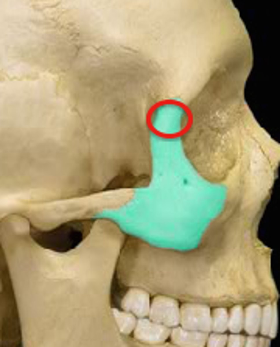 <p>the lateral rim of the eye socket formed by a process of the frontal bone and a process of the zygomatic bone</p>