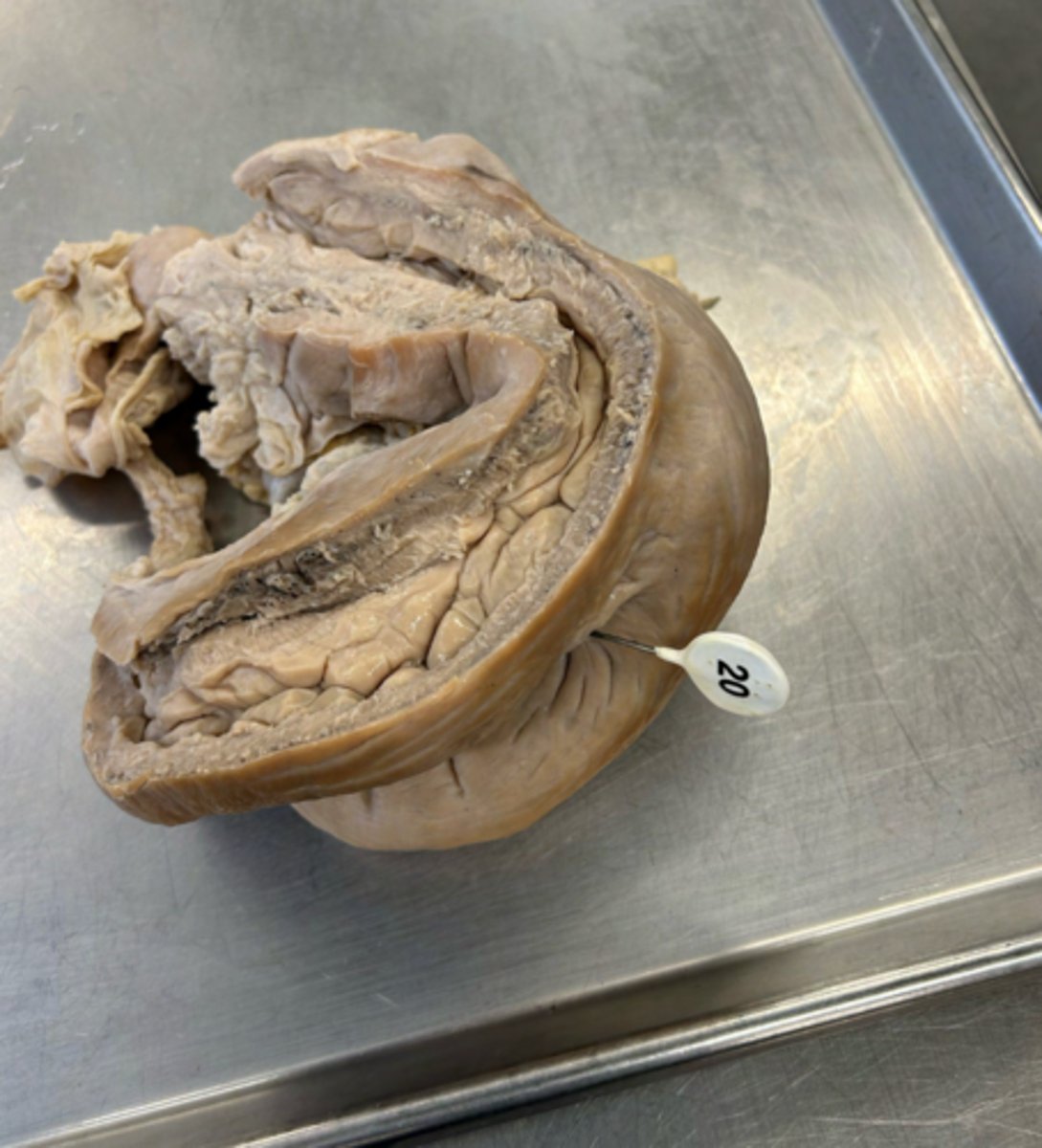 <p>ID the pinned structure.</p>