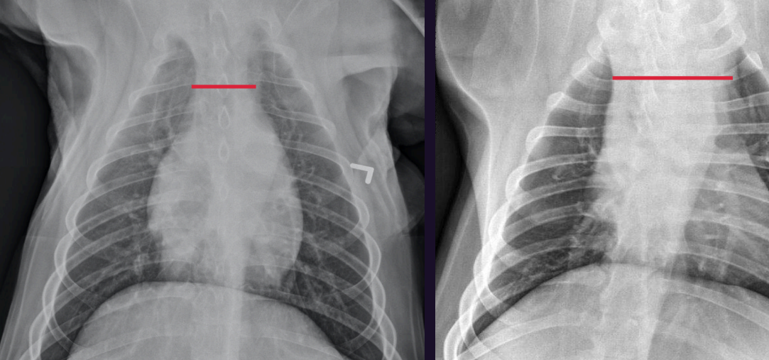 <p>Which is abnormal, why?</p>