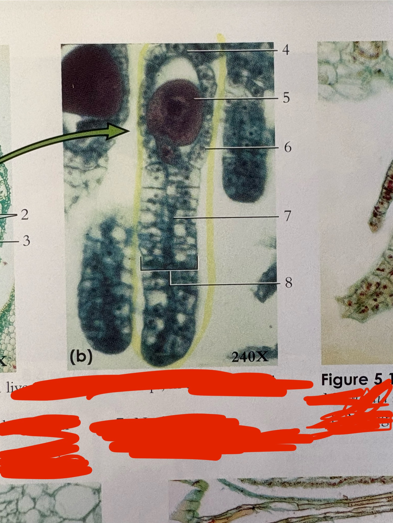 <p>What is the highlighted structure *</p>