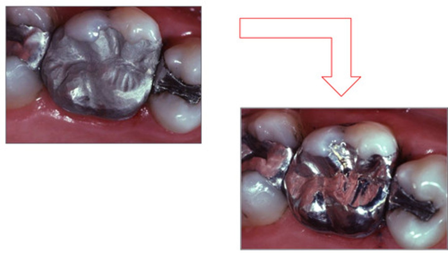 <p>You must wait __ hours before polishing amalgam</p>