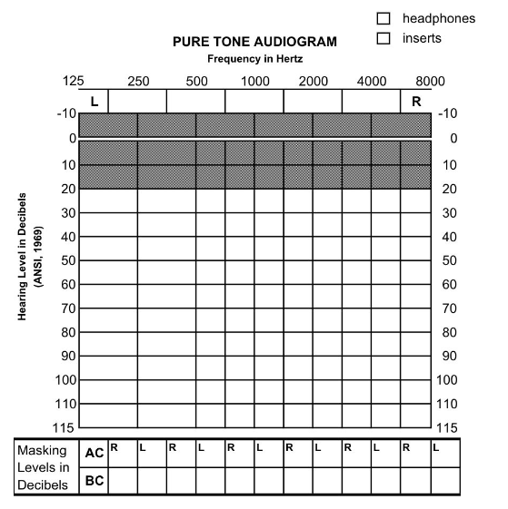 <p>X-axis: frequency (Hz)</p><p>Y-axis: hearing level (dB HL)</p>