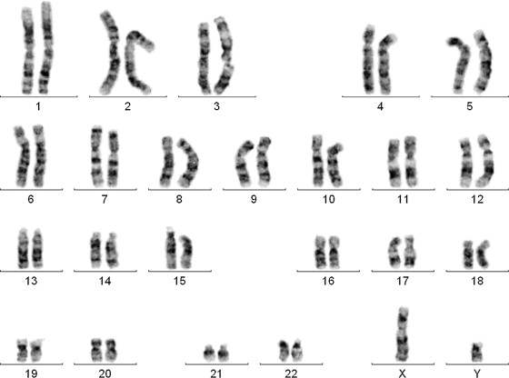 <p>There are 23 pairs of human chromosomes T/F?</p>