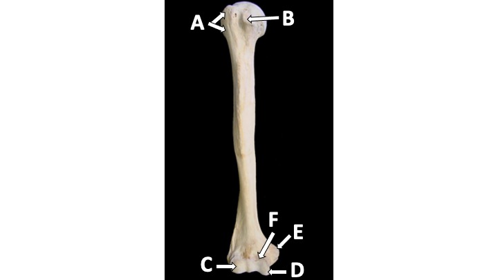 <p>What type of bone marking is B? (hint: superior portion of body)</p>