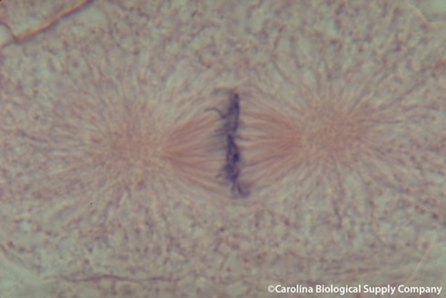 <p>2nd phase of mitotic division; chromosomes are fully condensed and lined up in the center (METAPHASE PLATE); each sister chromatid is attached</p>