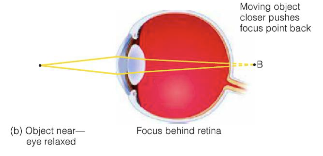 <ol><li><p>Can accommodate for CORNEA by contracting (getting thicker) or dilating (getting flatter) to do the remaining focusing work</p></li><li><p>Looking at a far-away object, the lens is flat</p></li><li><p>closer → if it doesn’t contract → blur&nbsp;</p></li><li><p>After the lens contracts/thickens, the object is focused correctly</p></li></ol><p></p>