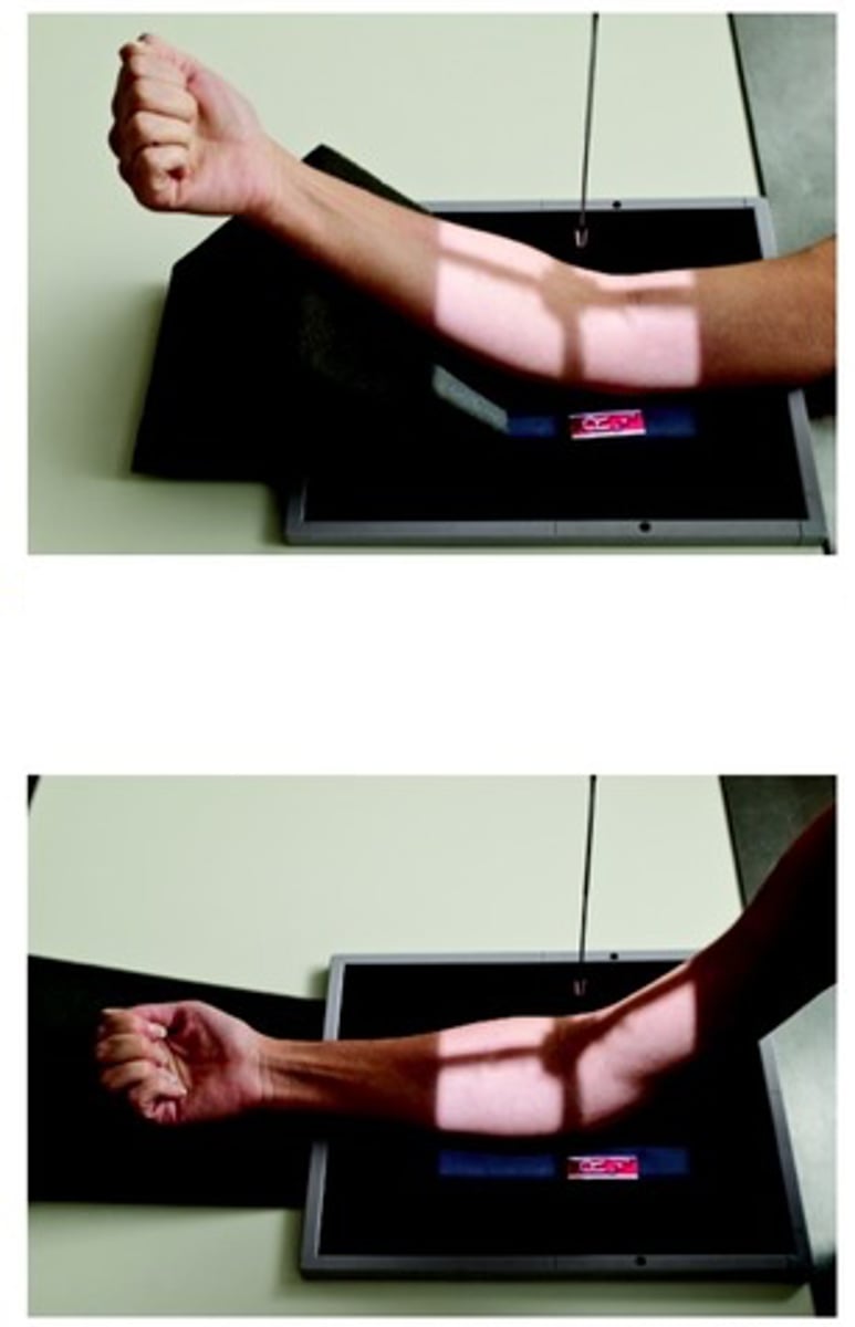 <p>CR perpendicular to mid-elbow joint (2 cm distal to midpoint line between epicondyles)</p>