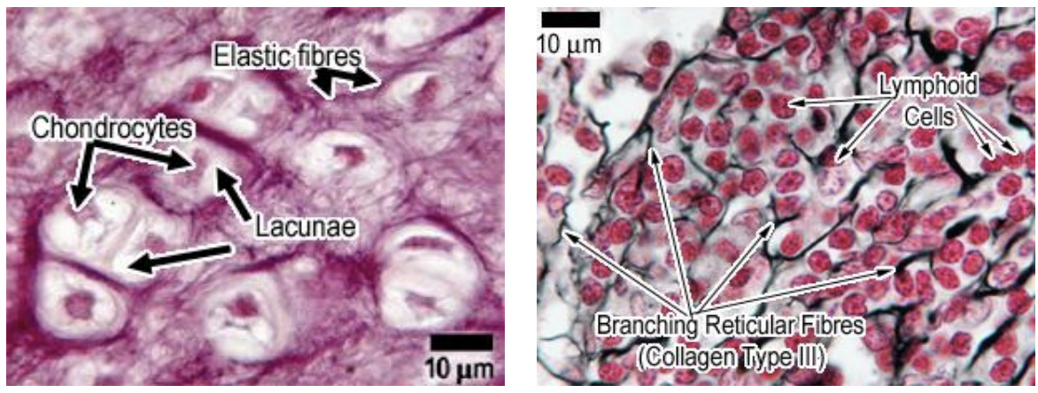 <p><strong>collagen</strong> (thick and strong)</p><p>• Composed of the protein collagen • Great tensile strength • Five sub-types (I-V), found in different areas of the body</p><p><strong>elastic</strong> (heart has it)</p><p>• Composed of the protein elastin • Ability to stretch and bounce back</p><p><strong>reticular</strong> (like lymph nodes, spleen)</p><p>• Modified type III collagen filaments • Secreted by reticular cells</p>