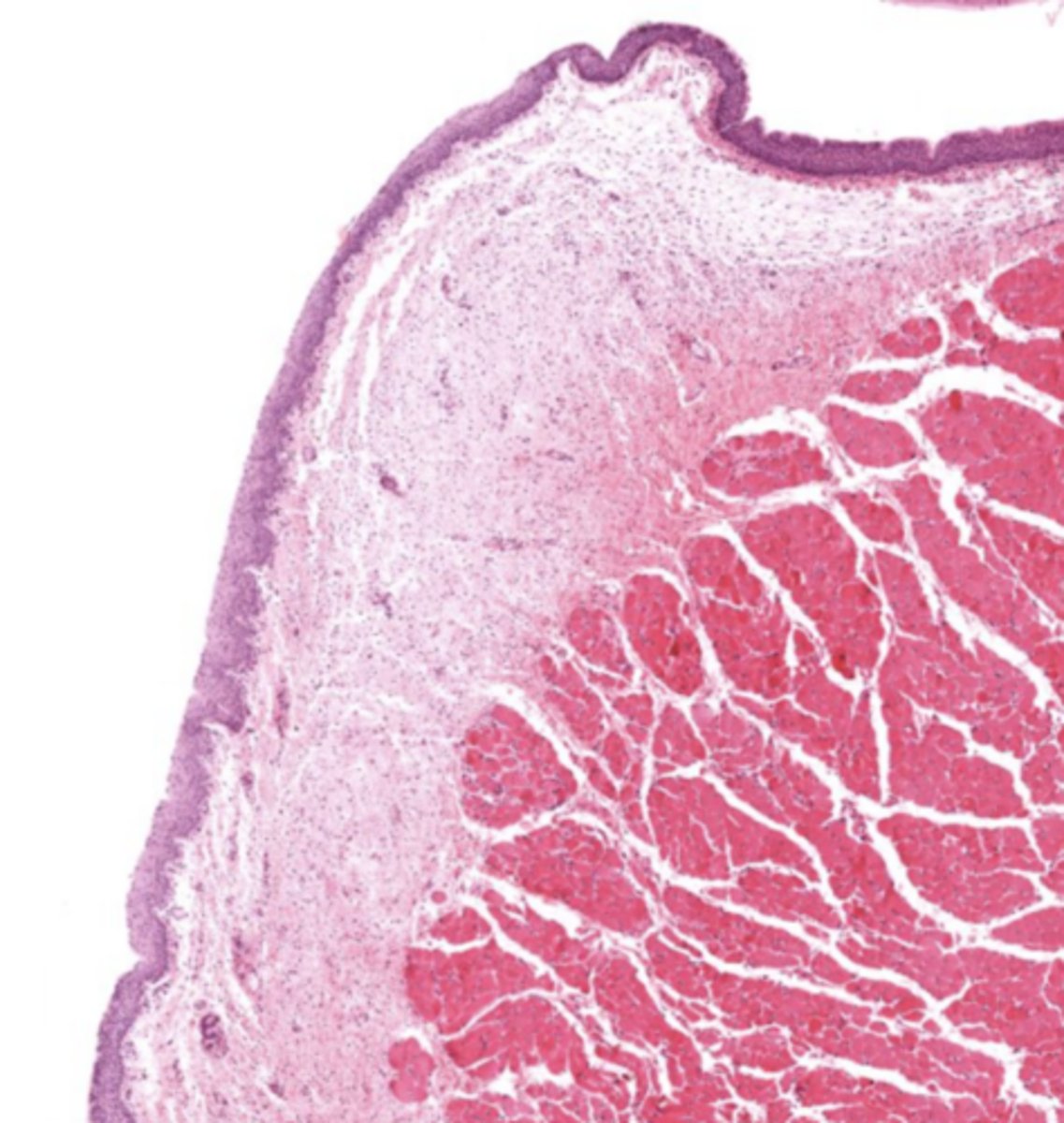 <p>A band of elastic fibers.</p>