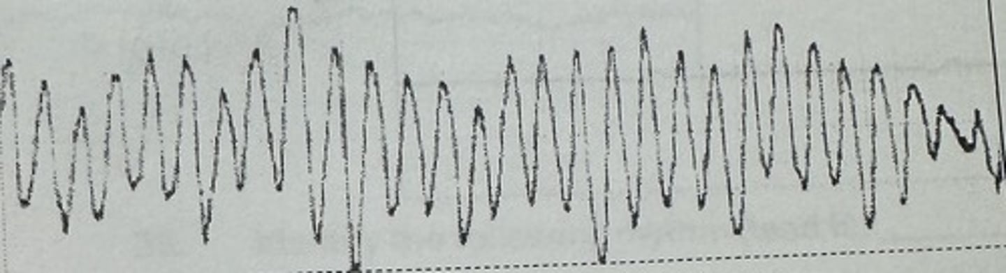 <p>identify the rhythm</p>
