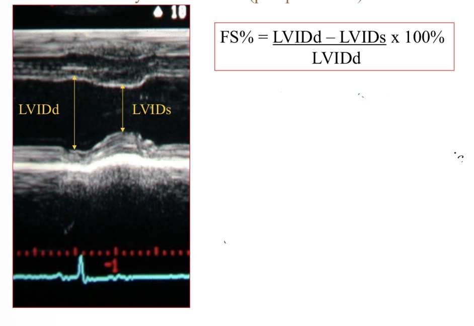 <p>Fractional shortening shows what</p>
