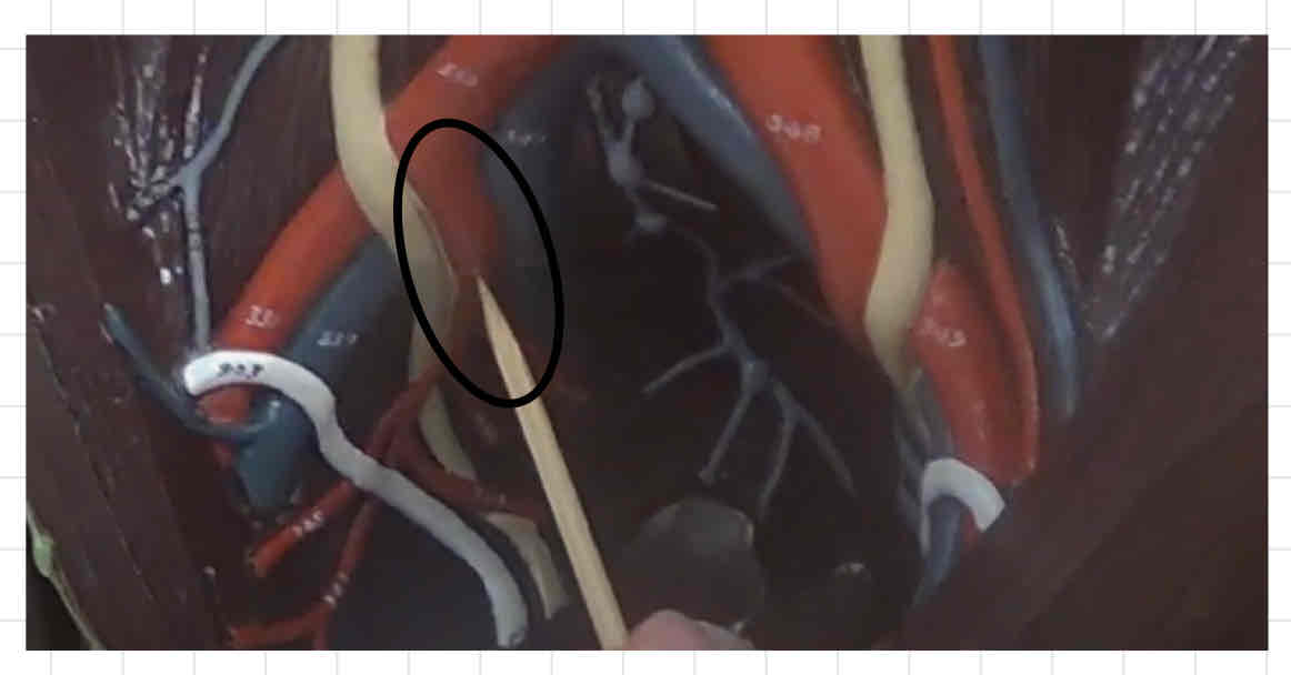 <p>what is this? (torso model)</p>