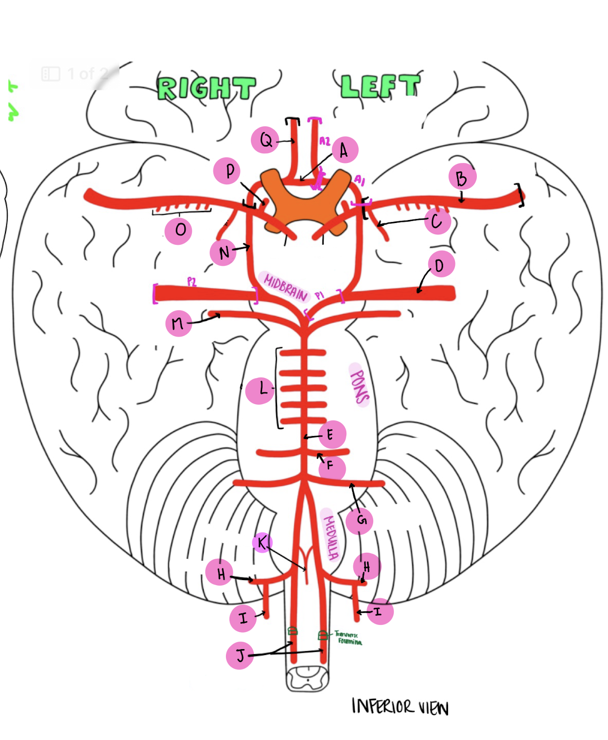 <p>What artery is labeled L?</p>