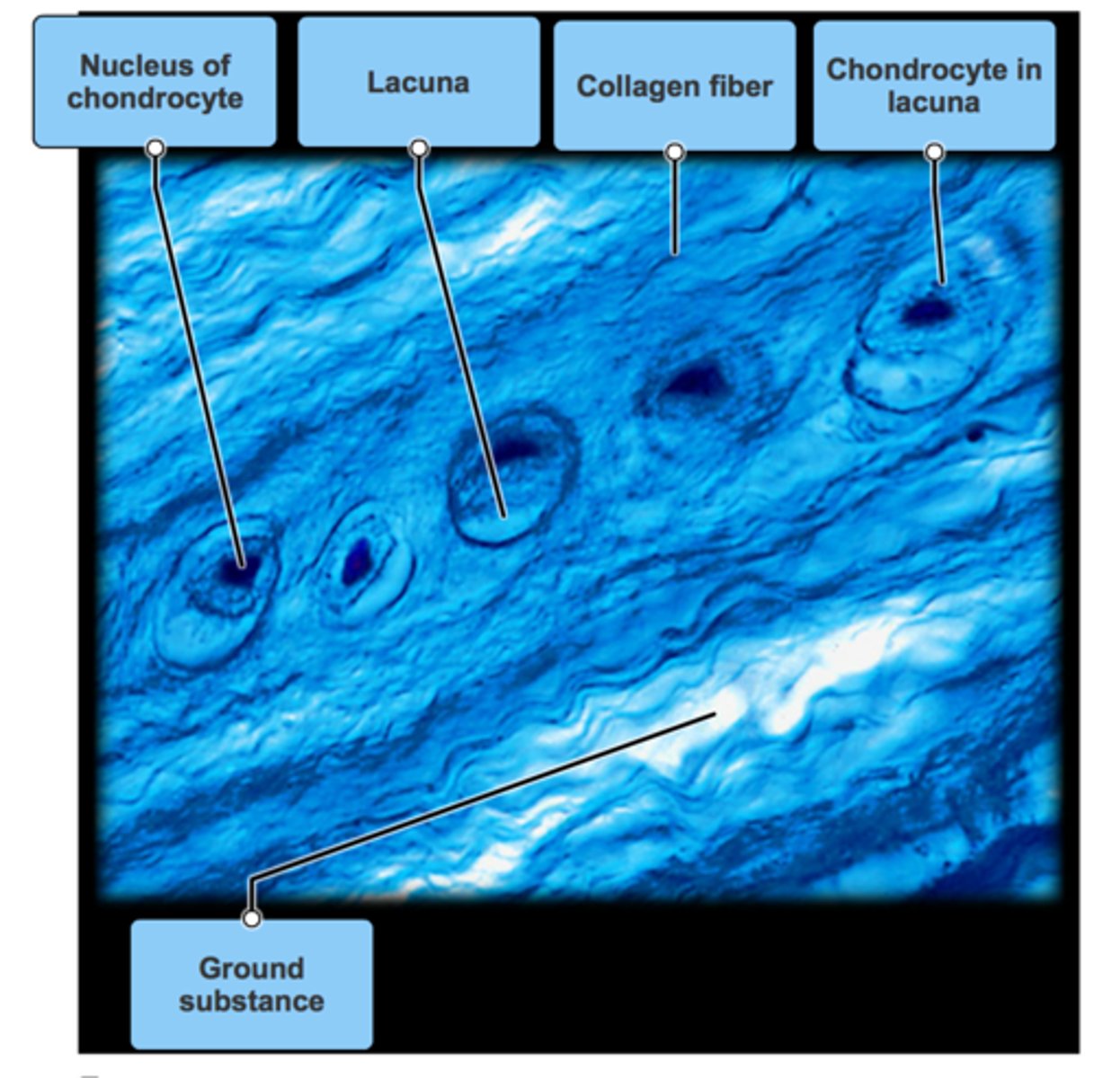 <p>Function - Tensile strength with the ability to absorb compressive shock.</p><p>Location - Intervertebral discs, pubic symphysis, discs of knee joint.</p>