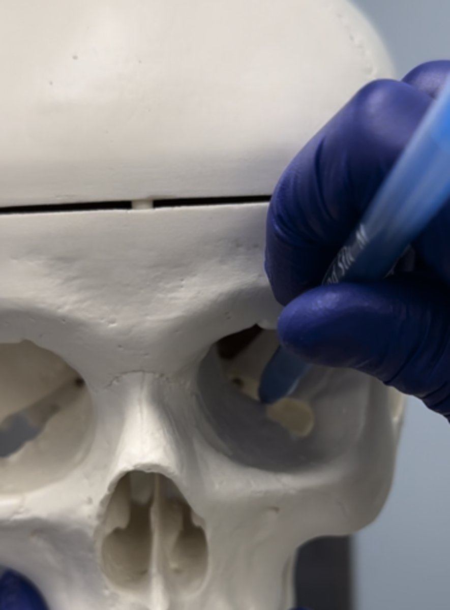 <p>The opening shown is the</p>