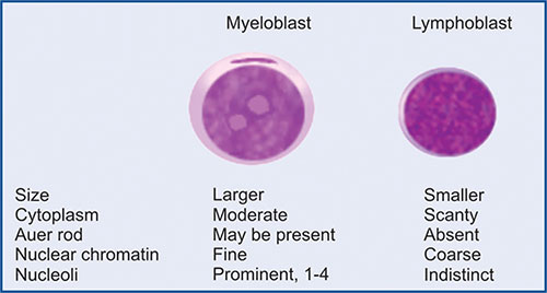 <ul><li><p><strong>myeloblasts </strong>have <u>auer rods</u>, <strong>lymphoblasts </strong><u>do not</u></p></li><li><p><strong>myeloblasts </strong>have a moderate amount of <u>cytoplasm</u> and looks <u>basophilic</u>, <strong>lymphoblasts </strong>do not have a lot of cytoplasm</p></li><li><p><em>cytochemical stains can also determine the cell lineage</em></p></li></ul><p></p>