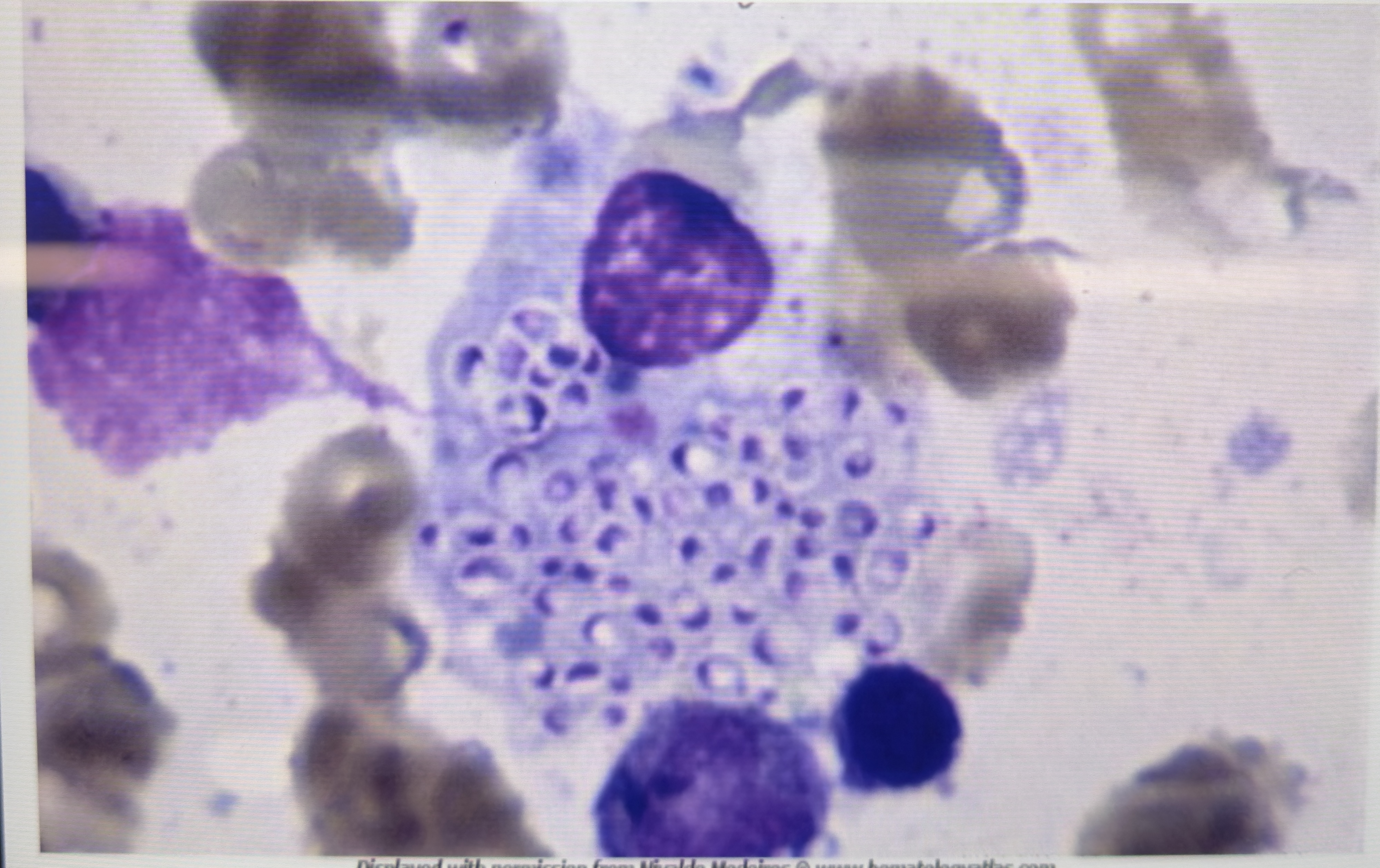 <p>HIV-positive man with chronic cough, hepatosplenomegaly, pancytopenia, elevated liver enzymes. Bone marrow aspirate shows intracellular oval yeast forms within macrophages. What is the most likely pathogen?</p><p></p>
