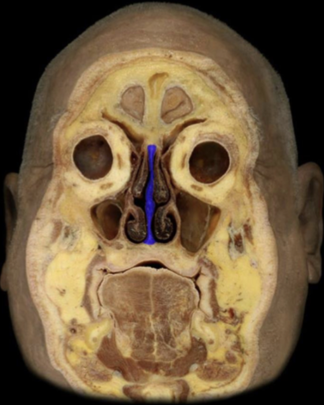 What structure is highlighted in blue?