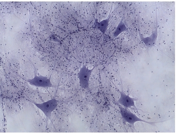 <p>what tissue is this?</p>