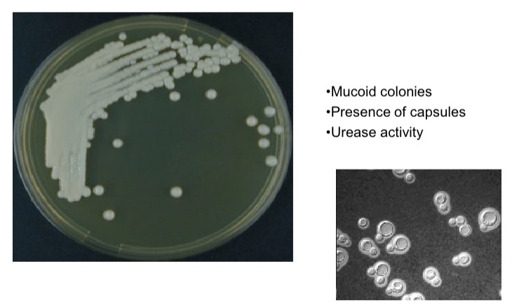 <p>Mucoid colonies, presence of capsules </p><p></p>