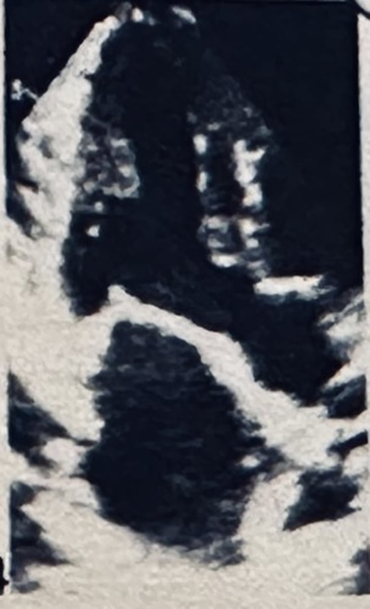 <p></p>