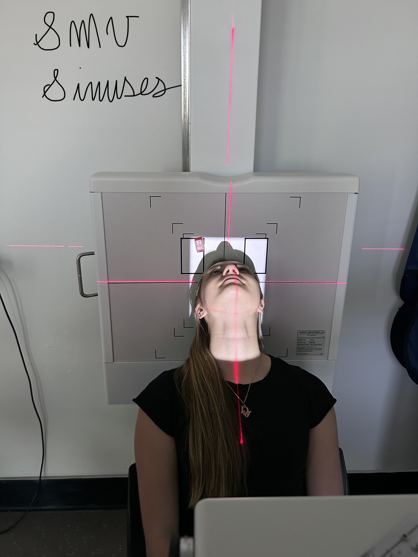 SMV Sinuses