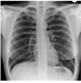 <p>Identify soft tissues/what are you looking for?</p>