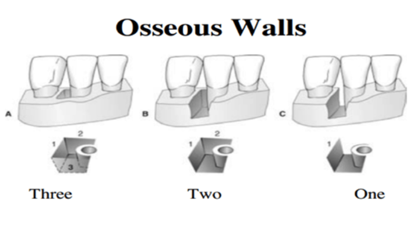 <p>a 3 wall defect. The more walls (higher #) means there are more walls supporting the tooth</p>