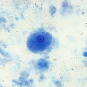 <ul><li><p>4-12 um</p></li><li><p>small, central karyonsome</p></li><li><p>even, peripheral chromatin</p></li></ul><p></p>