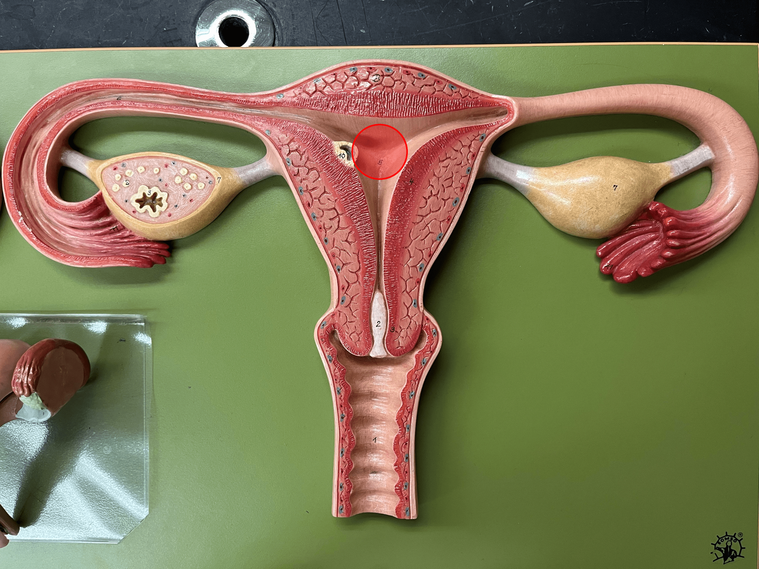 • The space within the uterus.

• Cut off at the internal os of the cervix.