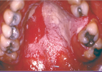 <p>what is the first step you would take to reach a diagnosis of this lesion </p>
