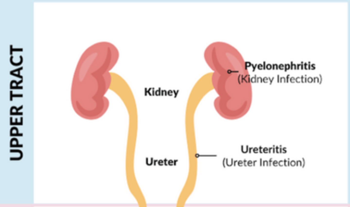 <p>fever, chills, flank pain, systemic manifestations</p>