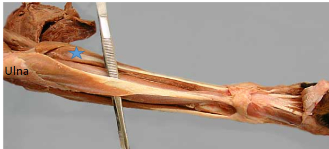 <p>Flexor carpi radialis m.</p>