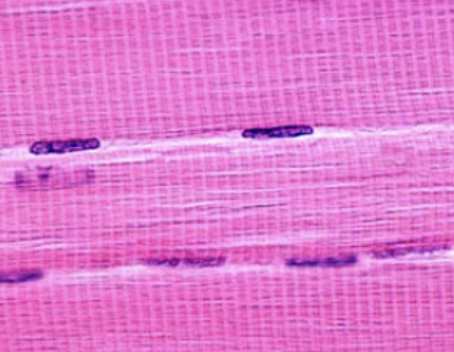 <p>striations</p>