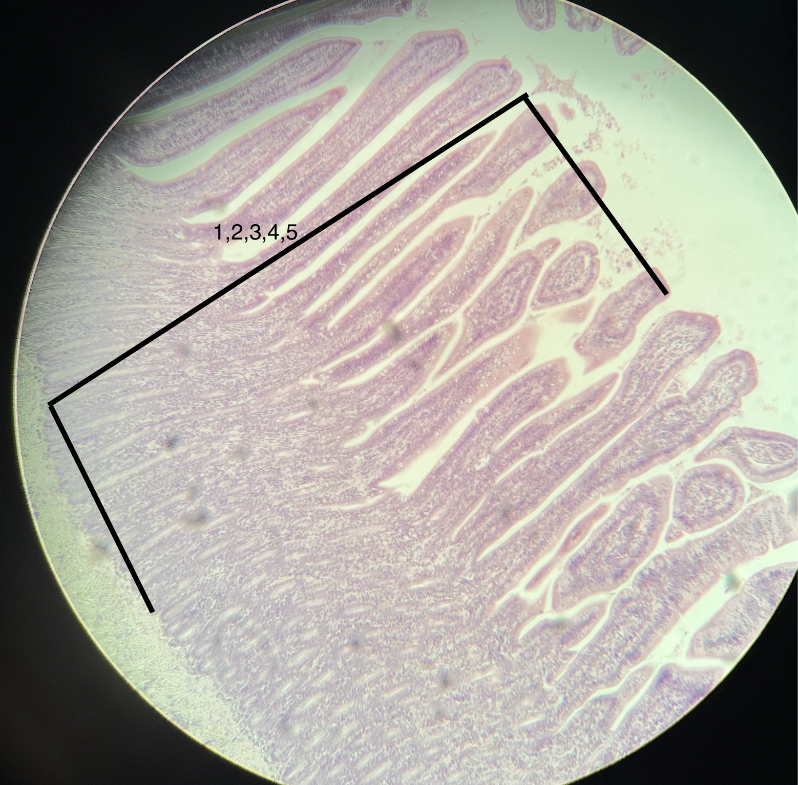 <p>1, 2, 3, 4, 5</p>