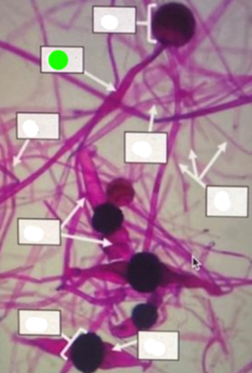 <p>Specialized hyphal structure that holds the sporangium, elevating it for better spore dispersal.</p>