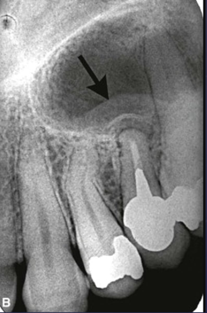 <p>What are the arrows pointing to?</p>