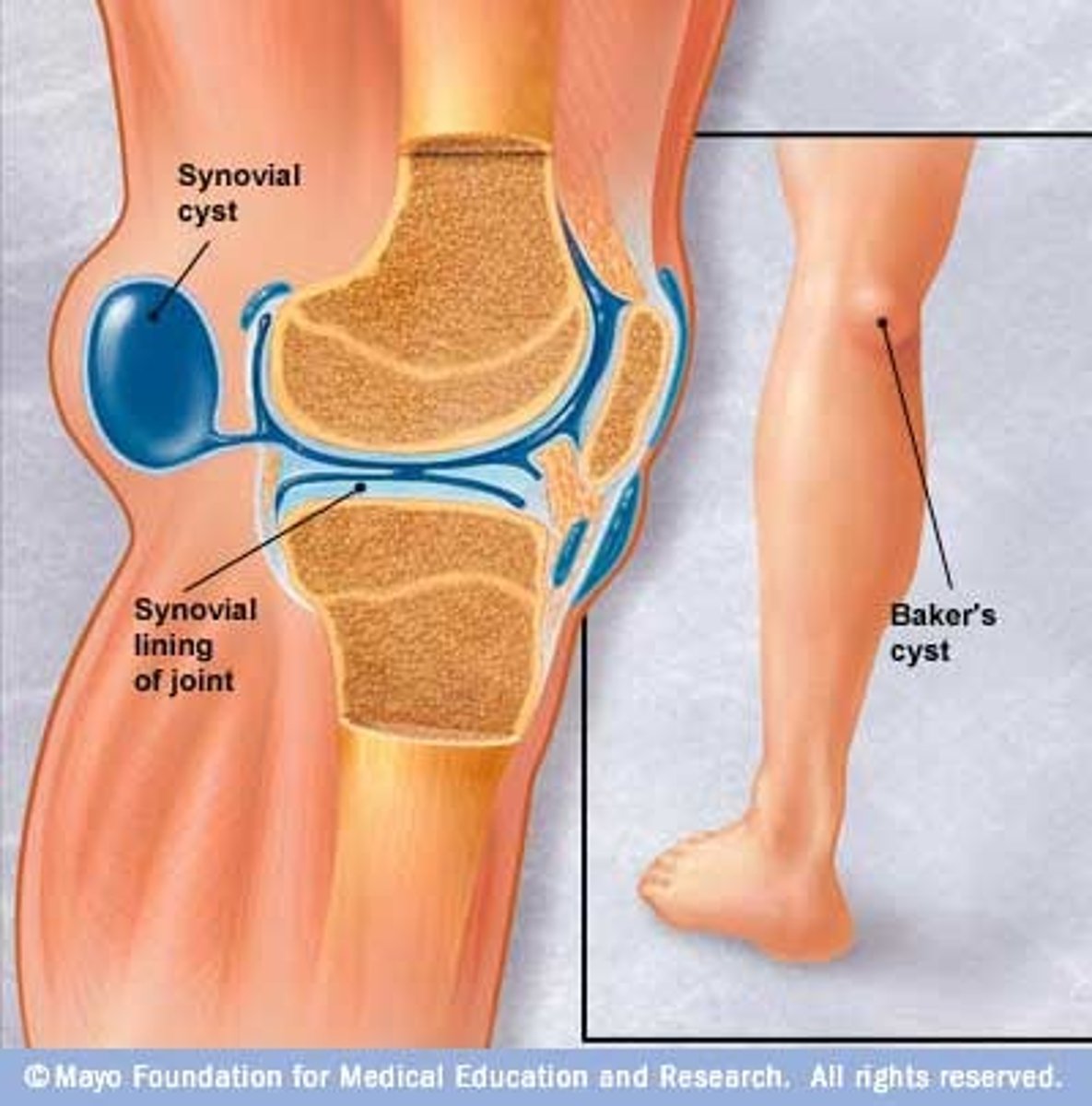 <p>A: Tibial nerve</p>