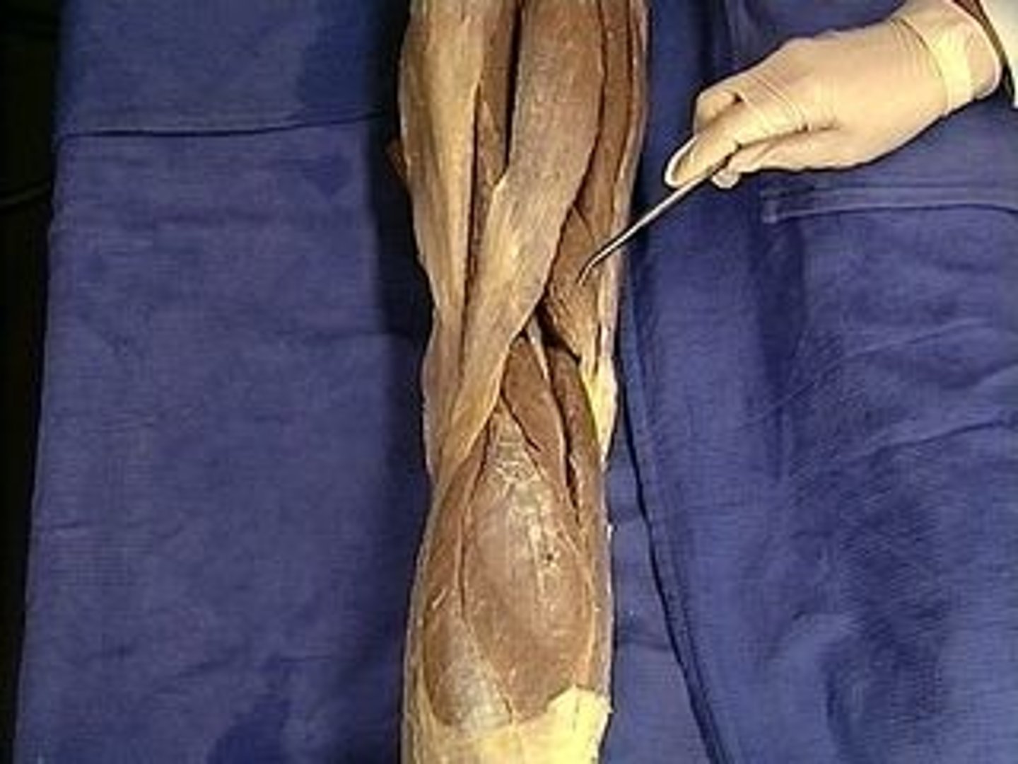 <p>Description: Deep to Semitendinosus</p>