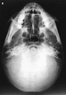 <p>What view is this?</p>