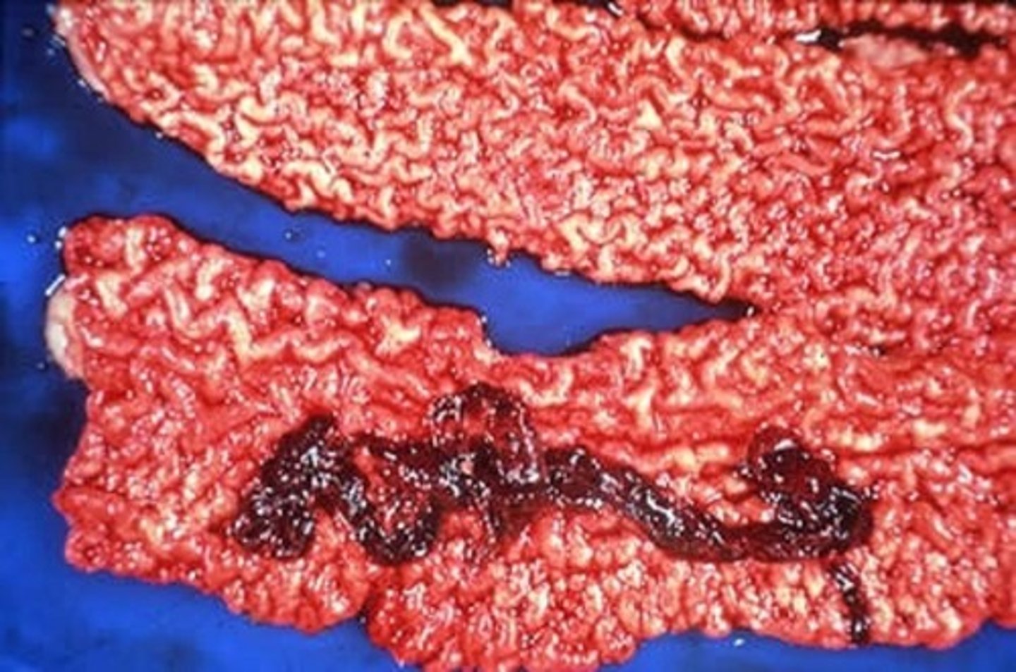 <p>Causes a highly fatal, necrohemorrhagic enteritis, most commonly affecting piglets 1-5 days old.</p>