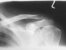 <p>What type of projection, position and anatomy is this?</p>