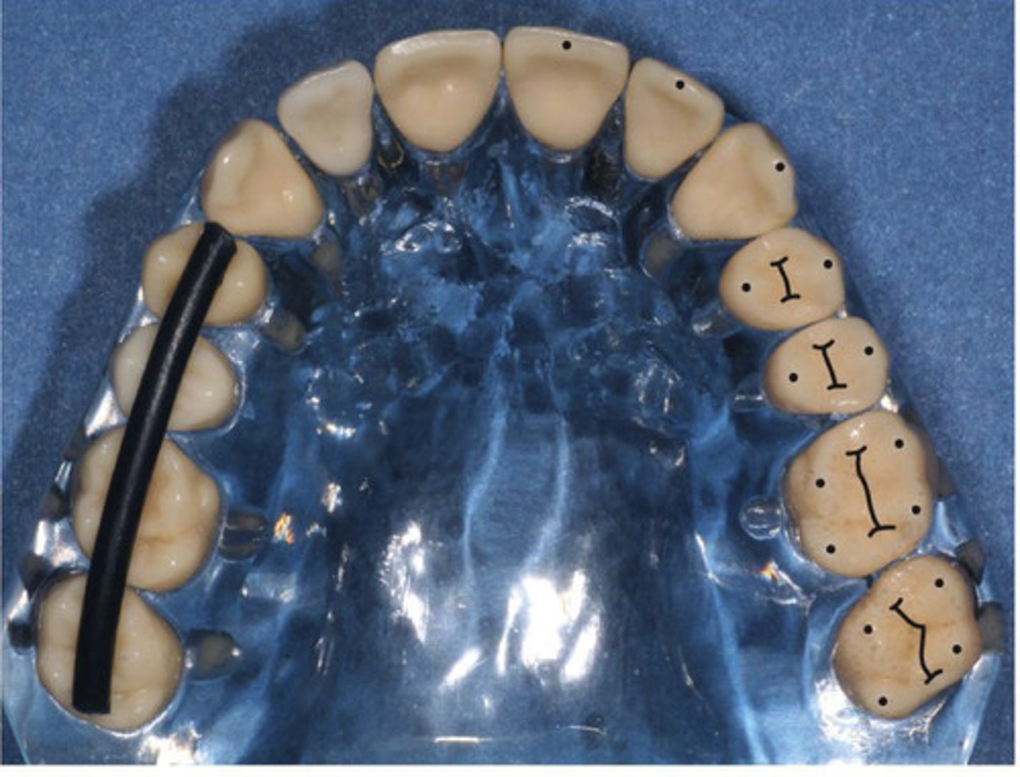 <p>all buccal and lingual cusp tip surfaces follow imaginary parabolic lines that are parallel to one another</p>
