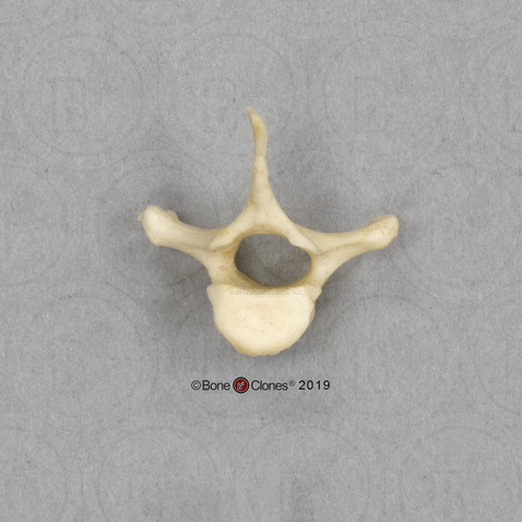 <p>Identify the part of the vertebra and explain what diagnostic features helped you reach your conclusion.</p>